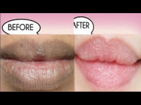 Cách tẩy tế bào chết-How To Get Natural Pink Lips FAST Using Only 2 INGREDIENTS ("Home Remedies") 3