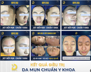 Khám phá bảng giá và quy trình chất lượng tại Dr. Choice Clinic HCM 20